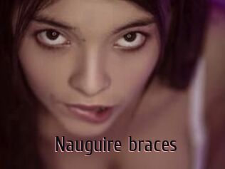 Nauguire_braces